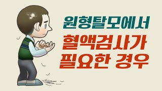 원형탈모 치료시 혈액검사가 필요한 경우