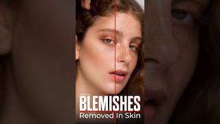 How To Blemishes Remove in Skin in Photoshop | Photoshop Tutorial #shorts