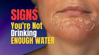 All the Signs That You’re Not Drinking Enough Water!!