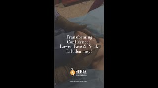 Transforming Confidence: Lower Face & Neck Lift Journey!