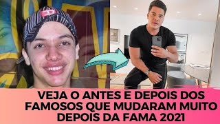 VEJA O ANTES E DEPOIS DOS FAMOSOS QUE MUDARAM MUITO DEPOIS DA FAMA 2021