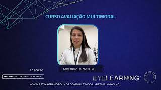 Aprimore seu conhecimento em Neuroftalmologia com a Dra. Renata Moreto