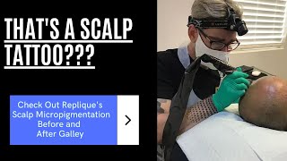 Scalp Micropigmentation SMP Sydney Replique Clinic