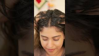 🥺എന്റെ എണ്ണപ്പാടം 🥲oily Hair Solution 🔧🔥 #Shorts #Hair