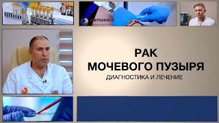 Лечение и диагностика рака мочевого пузыря.