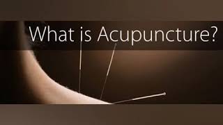 Acupuncture Treatment