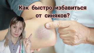 Как быстро избавиться от синяков? 911