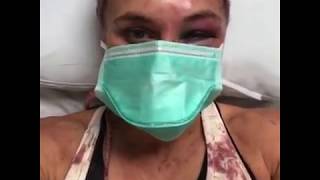 Yana Kunitskaya Fun At Hospital after UFC FIGHT.You think this is funny?