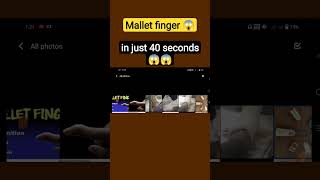 mallet finger #hamsterkombat #shortsviralvideo