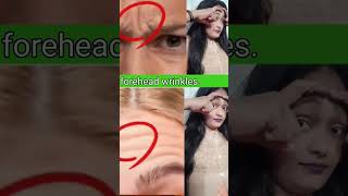 Viral forehead wrinkles facial yoga!antiyoga #skin yoga #double chin #faciallines