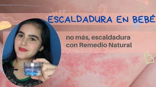 ESCALDADURA EN BEBE / NO MAS, ESCALDADURA CON Remedio NATURAL