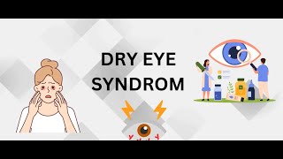 DRY EYE SYNDROM#eyes #ophthalmology #optometrylife #@insight by kanski