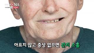 [메디컬다큐365] 더 나은 삶을 위한 선택, 전체 임플란트!(24.05.20 본)