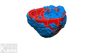 ARCHER Case Study: A Personalised Approach to Computational Heart Modelling 2/3