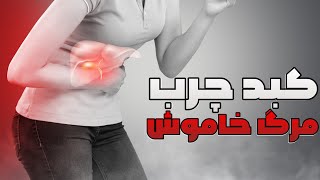 آیا ازعلایم چربی کبد روی اعضای بدن اطلاع دارید ؟ | علایم چربی کبد