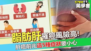 脂肪肝「罹癌風險高」台灣每4人就1人有！肝癌前兆不只疲倦消瘦「這5種症狀」要小心【 @57healthy  】#陳榮堅 醫師