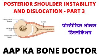 POSTERIOR SHOULDER INSTABILITY AND DISLOCATION = PART 3 - EPISODE- 39