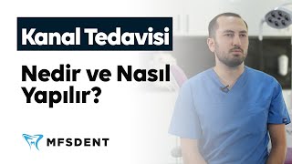 Kanal Tedavisi Nedir ve Nasıl Yapılır | Dt. Muhammed Ali Kurmuş