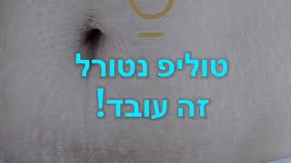 די לסימני המתיחה