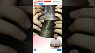 وصفة لتوقيف الشيب وصفات الدكتور عماد ميزاب Docteur Imad Mizab #short #shortvideo #shortsvideo