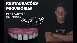 Restaurações Provisórias para facetas cerâmicas