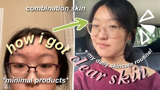 how i got rid of my acne in ONE MONTH + daily skincare routine *minimal products*