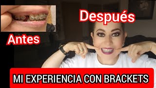 🛑Todo sobre mis BRACKETS/braces/frenos