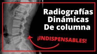 Diagnóstico de un problema de columna: Radiografías Dinámicas