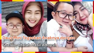 Daus Mini Tegaskan Anaknya dengan Shelvie adalah Hasil Adopsi.