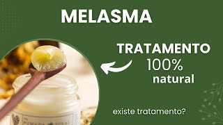 COMO TRATAR O MELASMA [SAIBA AGORA]