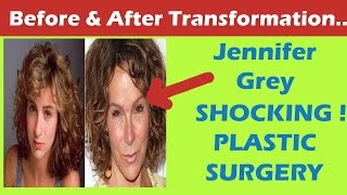 Jennifer Grey Plastic Surgery Before and After Full HD