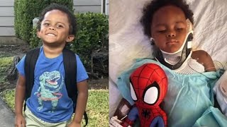 4-year-old boy severely injured in Pit Bull attack