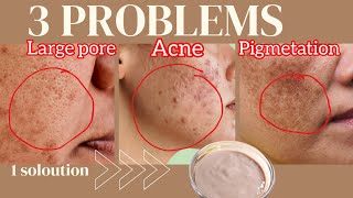 Say Goodbye to Dark Spot|Effective Face Masks for Pigmentation