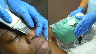 Deep Pore | Micro Peel Facial | Keisha J Lewis