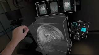 Apple Vision Pro can revolutionize medicine with 3D brain scans?!