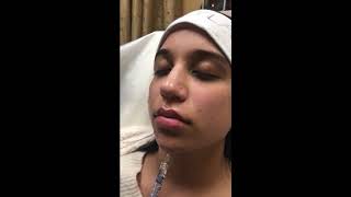 Jawline Re-Shaping - Afterglow Aesthetics - Dr. Shehla Ebrahim