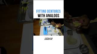 Fitting Dentures with Analogs