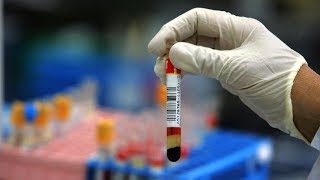 ✅  Il test del sangue che scova 50 diversi tipi di tumore