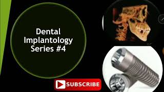 Dental Implants Review Series #4 - INBDE