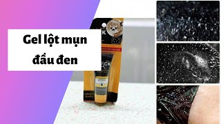 Review Kem, Gel lột mụn đầu đen Tốt, Hiệu quả nhất tại nhà