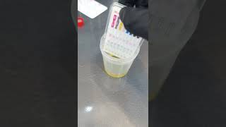 Urine drug test tutorial