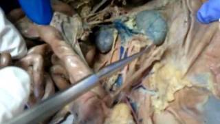 Cat Dissection - veins & arteries below diaphram I