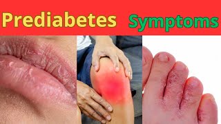 TOP 8 prediabetes symptoms  you most know: alarming signs  your blood sugar is too high.