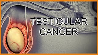 Testicular Cancer/Tumors