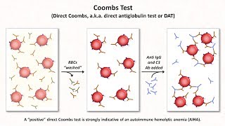 Anemia: Lesson 3 - Hemolysis