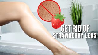 How To Get Rid OF Strawberry Legs In ONE DAY !