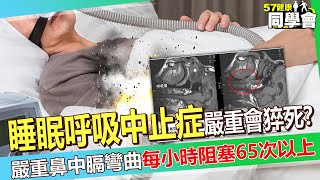 睡眠呼吸中止症「影響性功能」嚴重還會猝死！？ 45歲中年男打呼被嫌吵「嚴重鼻中膈彎曲」每小時阻塞65次以上！？【 @57healthy  】#蕭敦仁 醫師