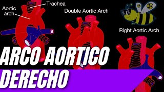 ARCO AORTICO DERECHO