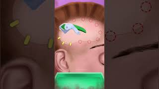 Head Injury Treatments | Asmr animation on Head Injury