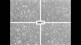 Time-Lapse Micrograph of the Last 24hr of Branching and Maturation of hPSC-derived 3D Lung Organoids